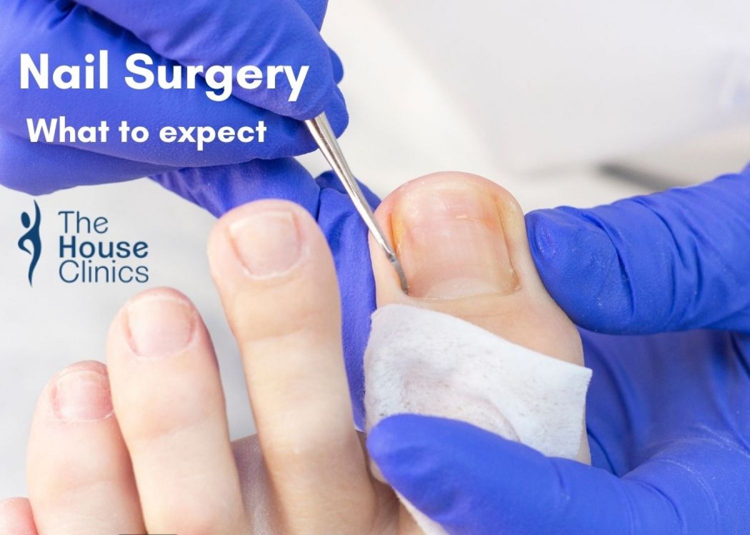 Pearls And Pitfalls Of Nail Surgery