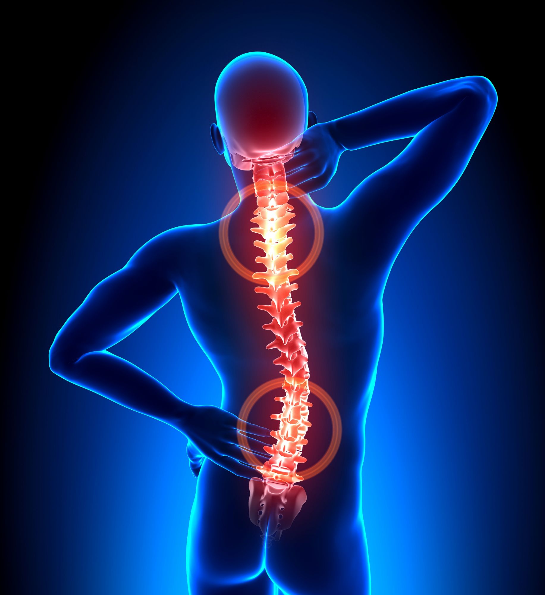 Low back pain: Symptoms and Common Treatments