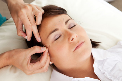 Acupuncture needles can help reduce the pain of Trigeminal Neuralgia, The House Clinics, Bristol