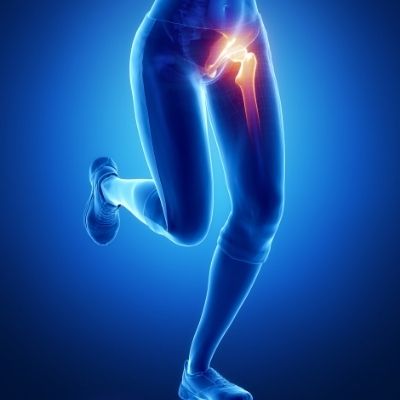 Outer Hip Pain: How to Prevent and Relieve It