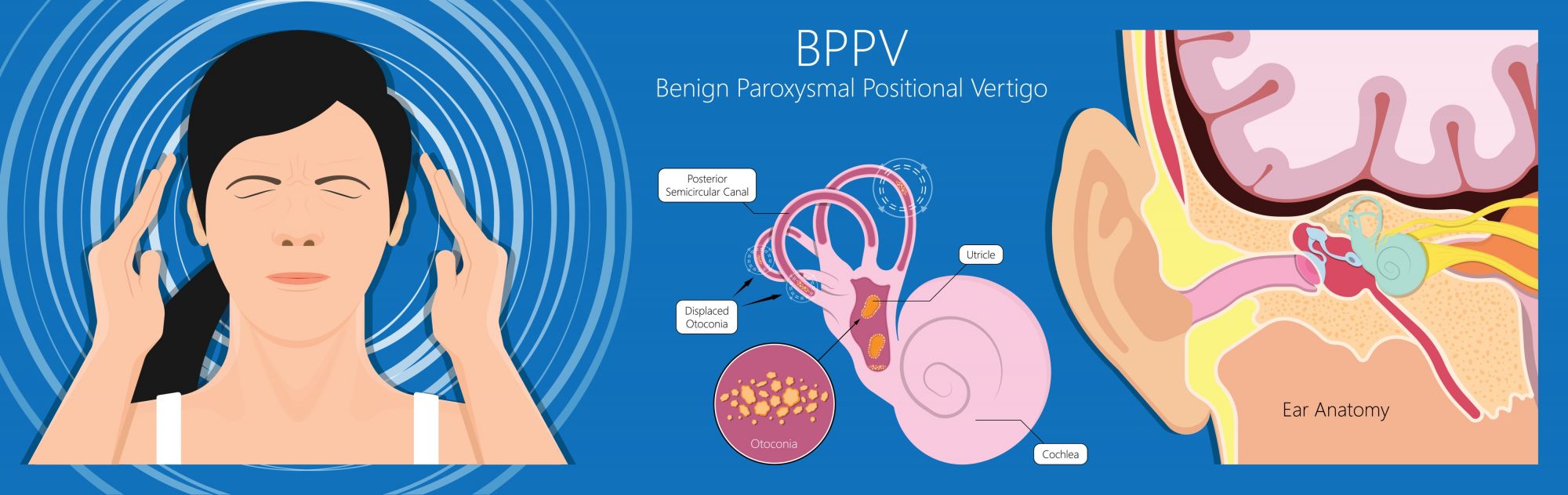 Chiropractic Treatment for BPPV, Vertigo and Dizziness: The House Clinics, Bristol