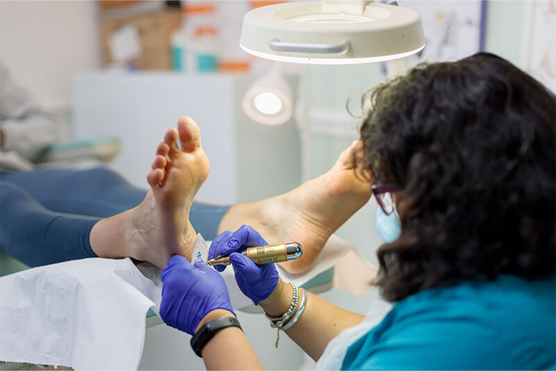 Verruca & Wart Removal Treatment